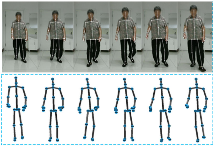 Classification of Gait Anomalies from Kinect